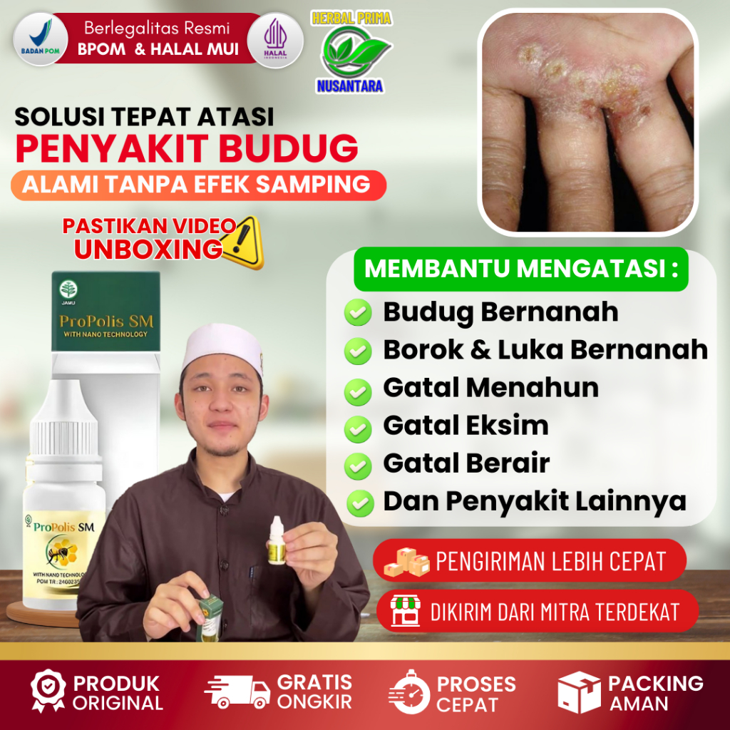 [COD] Obat Tetes Oles Penyakit Budug Murah - Obat Budugan - Obat Penghilang Buduk - Obat Buduk - Oba