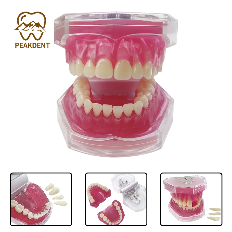 Phantom Gigi Lepas Pasang Model Pink PVC Edukasi