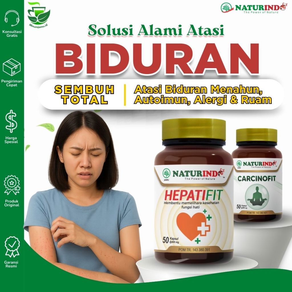 Obat Biduran Alergi, Obat Biduran, Obat Biduran Alergi Ampuh, Obat Biduran Alergi Ampuh, Obat Bidura
