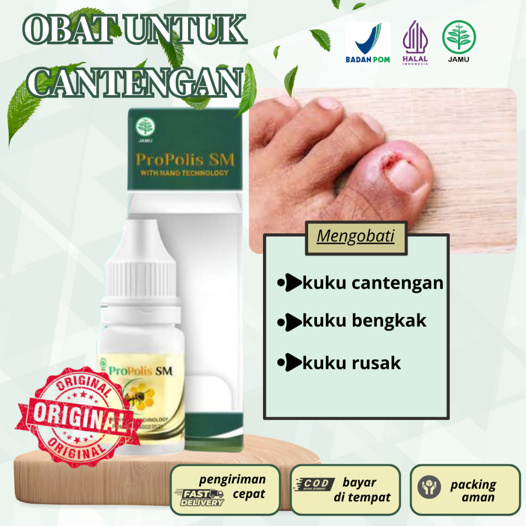 Obat Cantengan di kaki & di tangan, kuku hitam, kuku bengkak, cantengan bernanah-obat kuku