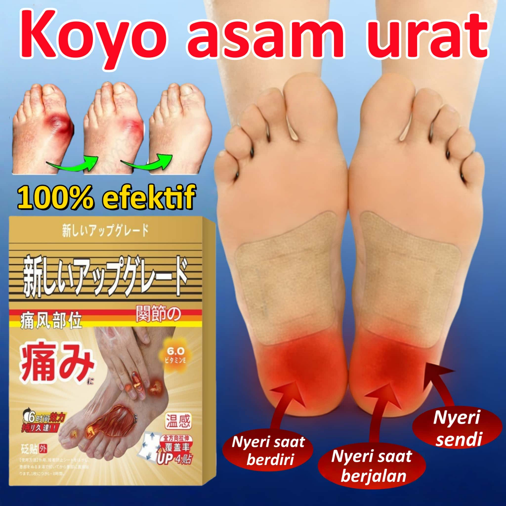 Koyo Asam Urat Koyo Kaki Pereda Nyeri Obat Sakit Kaki Obat Kaki Bengkak Koyo Lutut Nyeri Sendi Dan T