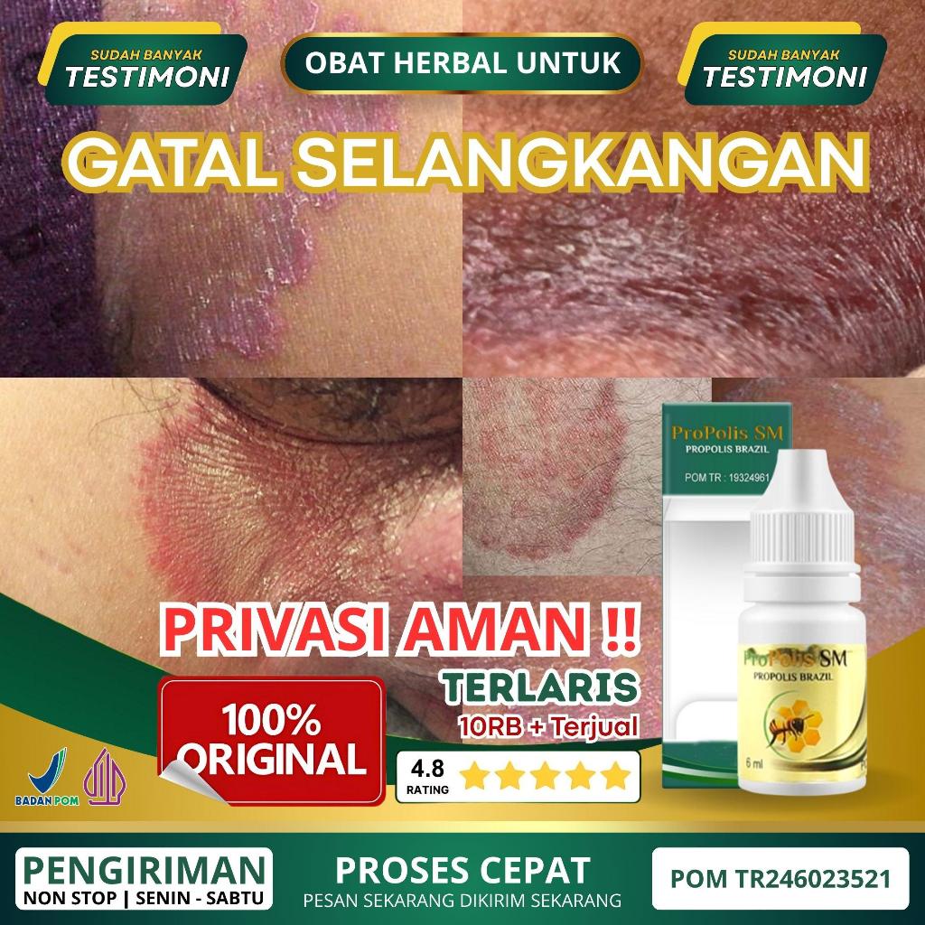 Salep Gatal Selangkangan, Selangkangan Hitam, Selangkangan Bersisik, Selangkangan Berjamur, Gatal Se