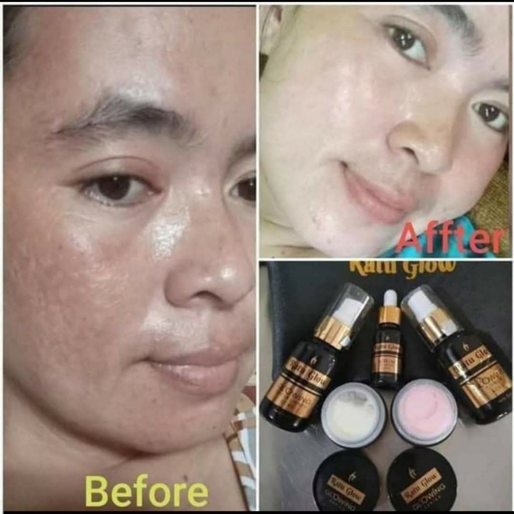 RATU GLOW PLATINUM SERIES 100% ORIGINAL (Paket Acne & Brightening) by H.Agus Salim Bucar
