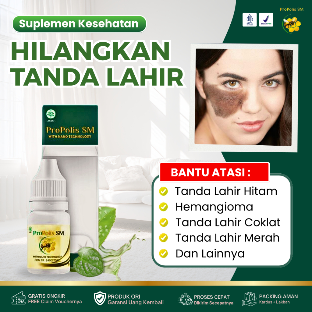 Obat Penghilang Tanda Lahir, Tanda Lahir Hitam, Obat Hemangioma, Gumpalan Darah Merah Pada Bayi, Tan