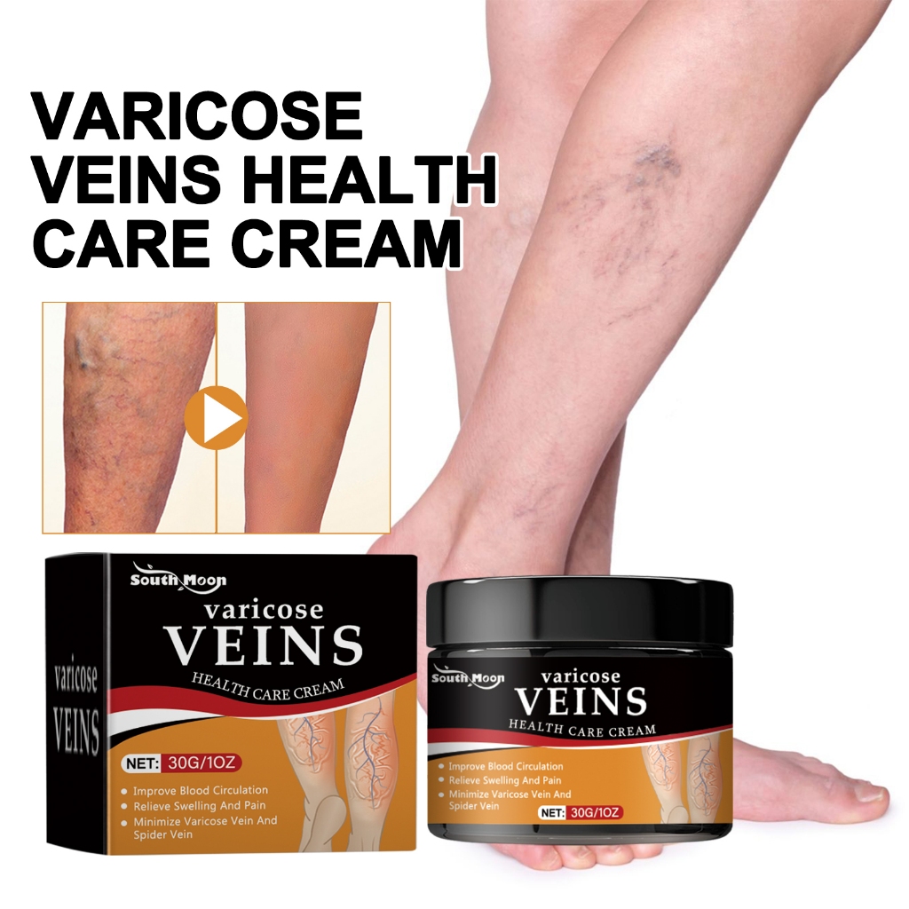 South Moon Varicose Veins Health Care Cream 30g Krim Perbaikan Varises Improve Blood Circulation Rel
