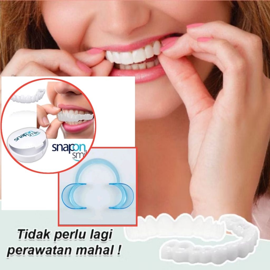 Gigi Palsu Snap On Smile 1 Set Atas Bawah, Mudah Dipasang & Dilepas