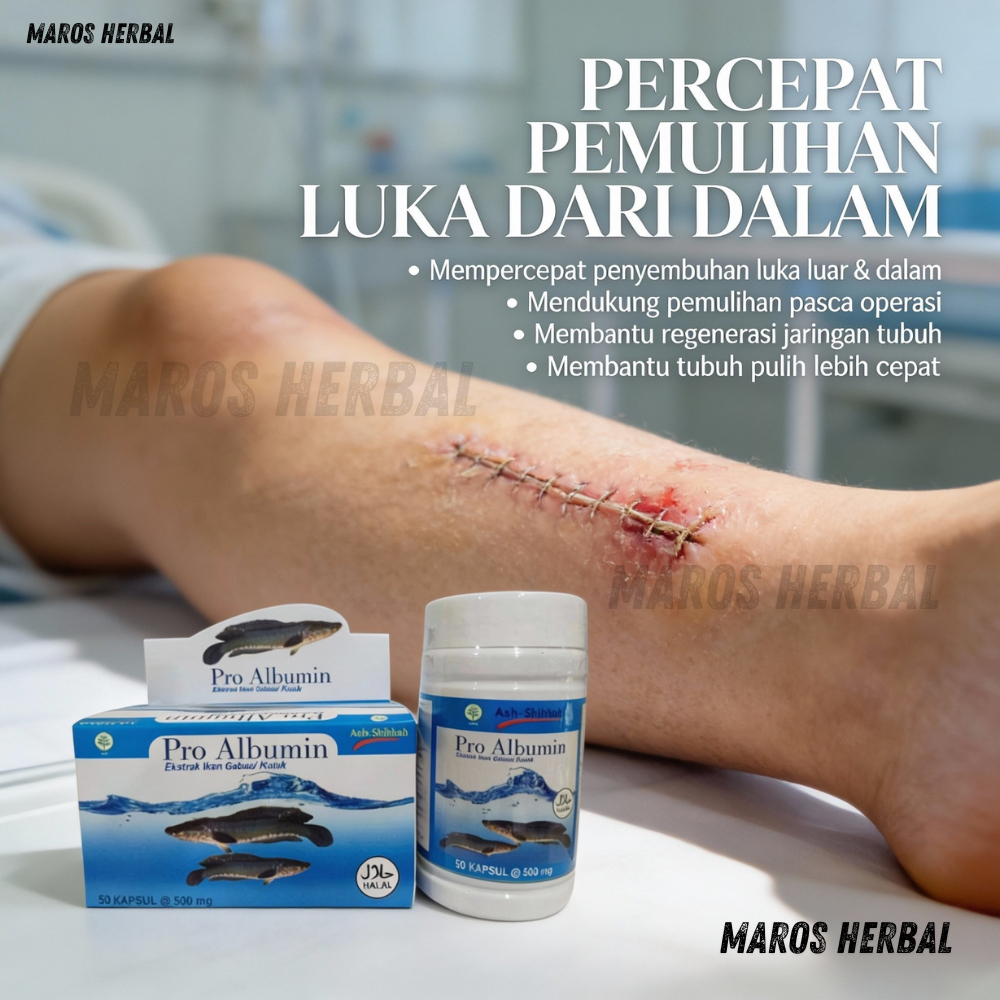 Pro Albumin Ektrak Ikan Gabus Mempercepat Penyembuhan Luka Pasca Operasi, Luka Bakar, Luka Jahit, Lu