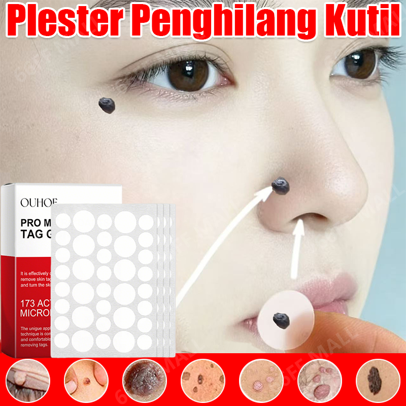 penghilang kutil dan tahi lalat Penghilang Tahi Lalat Di Wajah  kutil remover plester kutil skin tag