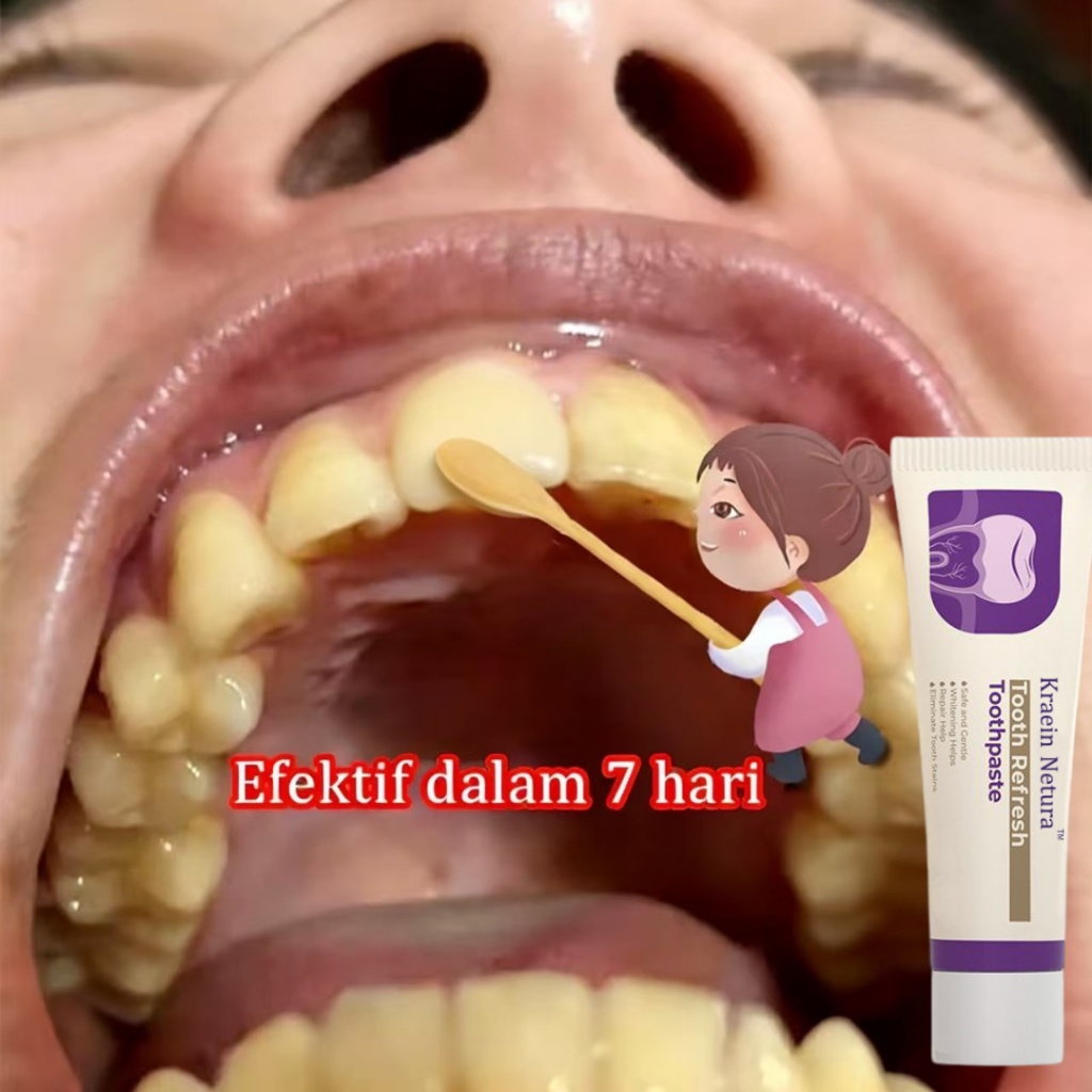 Tooth Refresh Toothpaste Bantu Perbaiki Redakan Masalah Akibat Gigi Sensitif Menghilangkan Kotoran G