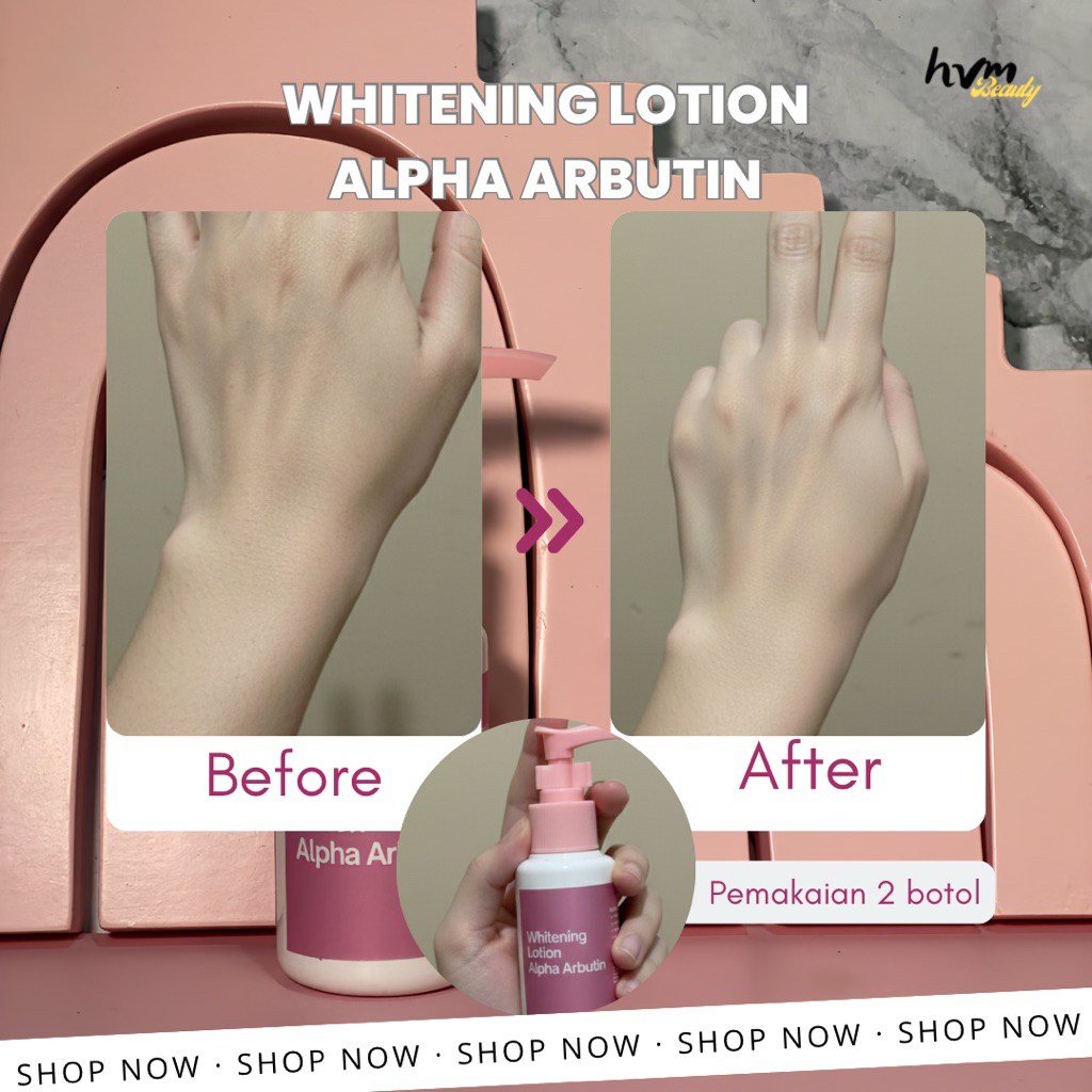 [HVM] Whitening Lotion Alpha Arbutin