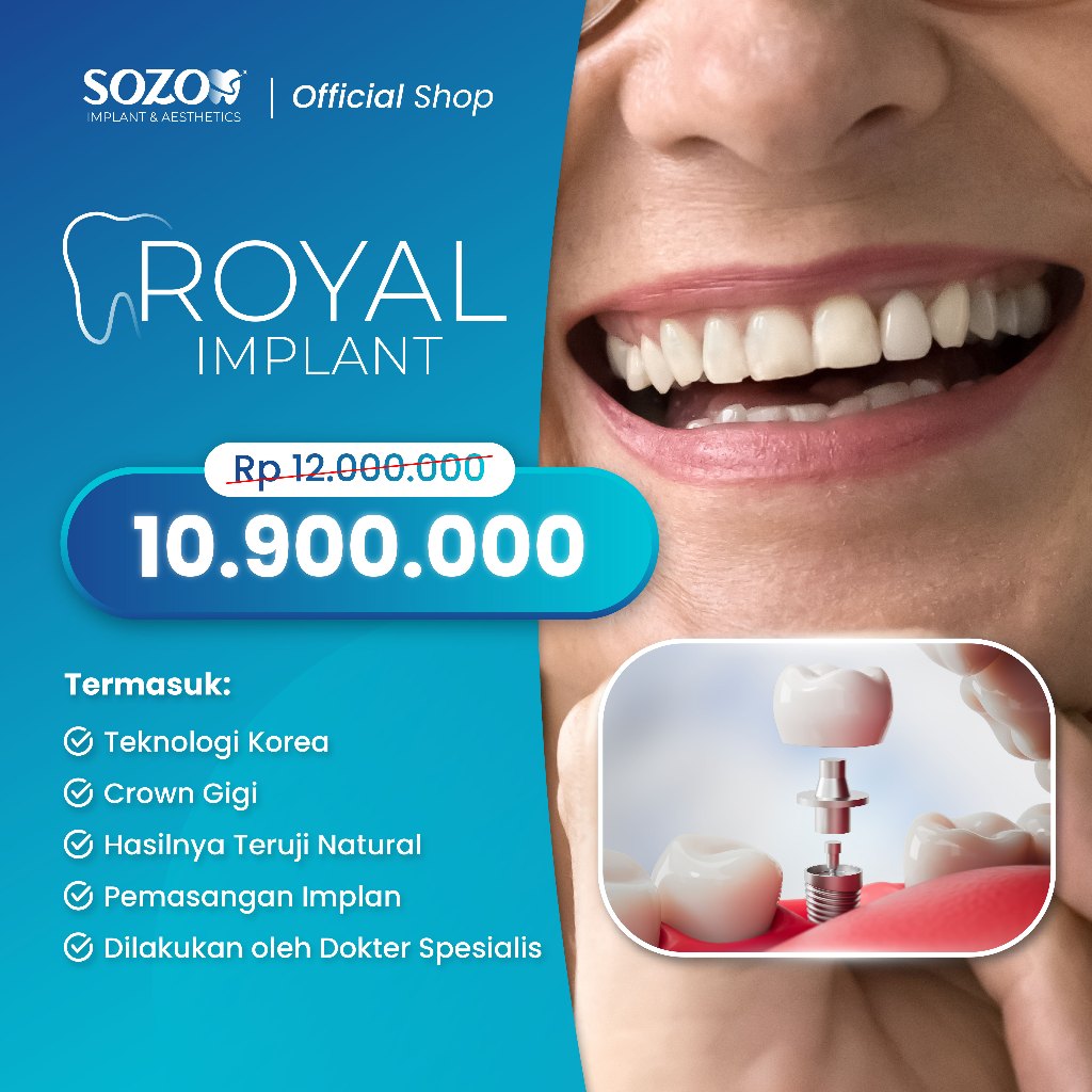ROYAL IMPLANT GIGI – SOZO IMPLANT & AESTHETICS