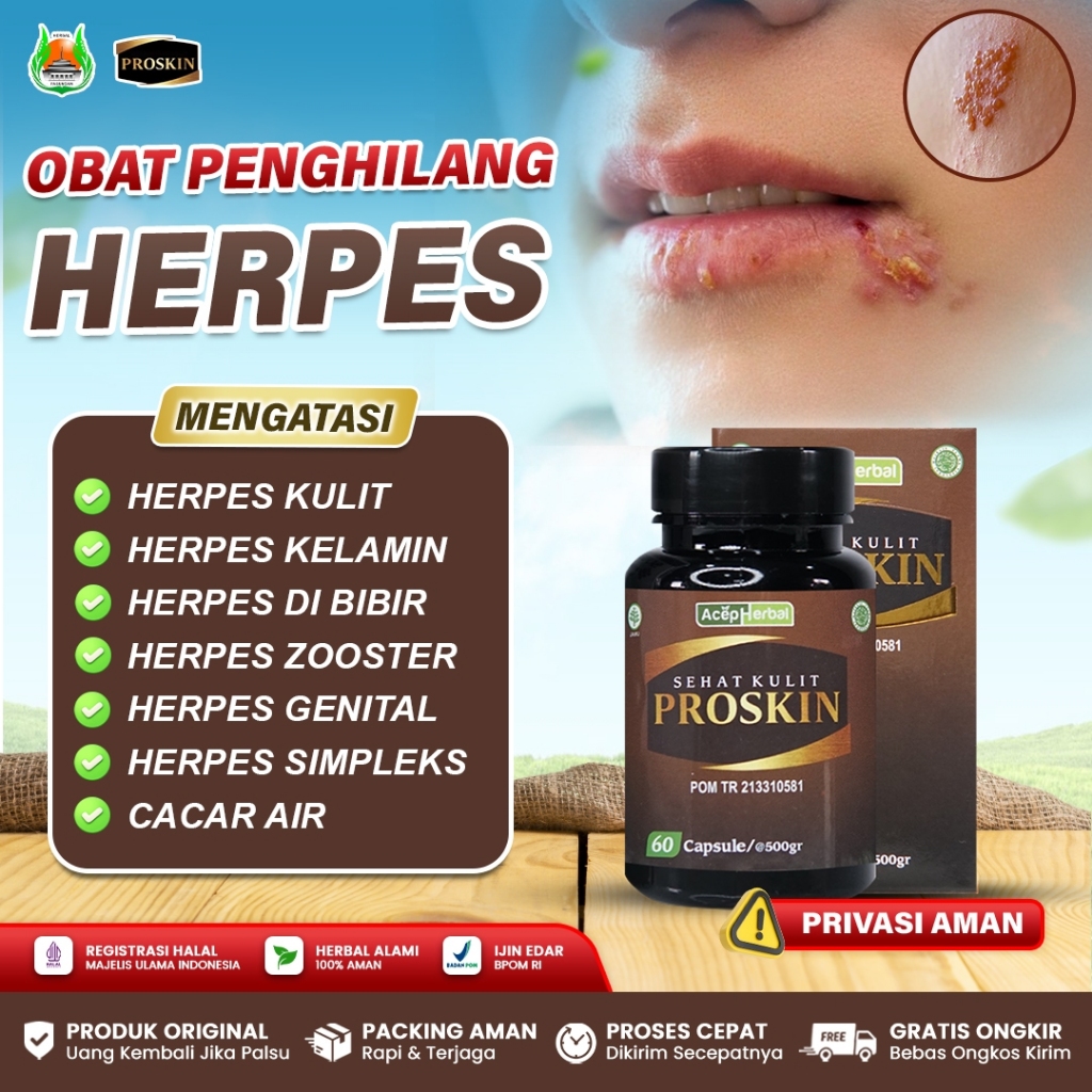 Obat Herpes Kulit, Herpes Zoster, Herpes Kelamin, Herpes Bibir, Herpes Genital - Proskin 60 Kapsul