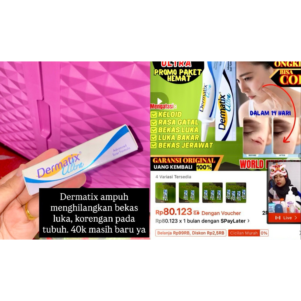 dermatix penghilang bekas luka ampuh