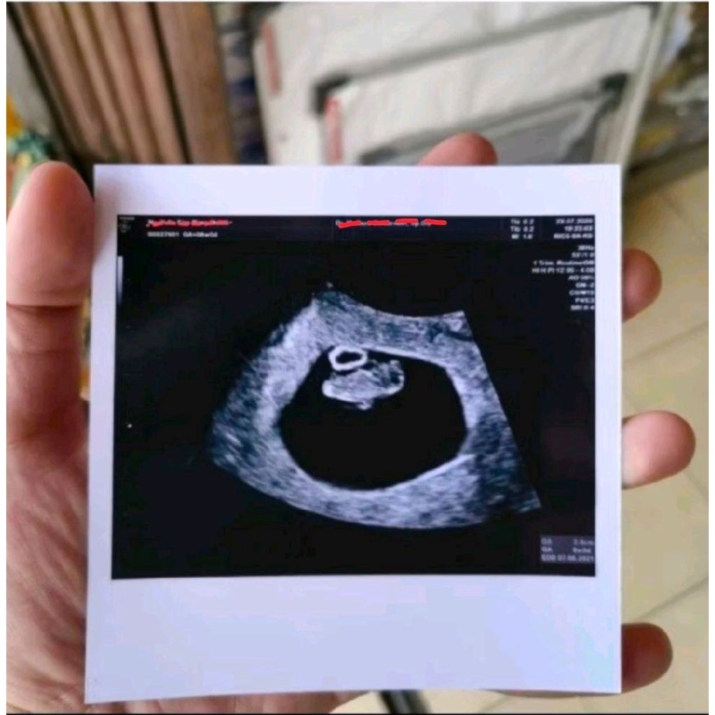 Jasa edit foto USG untuk kenang2an / prank