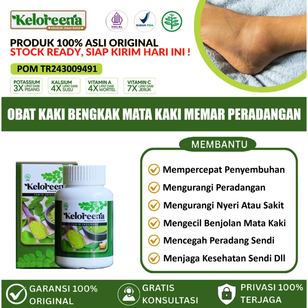 Obat Mata Kaki Bengkak, Pembengkakan Di Mata Kaki, Obat Bengkak Di Kaki, Pergelangan   Kaki Bengkak,
