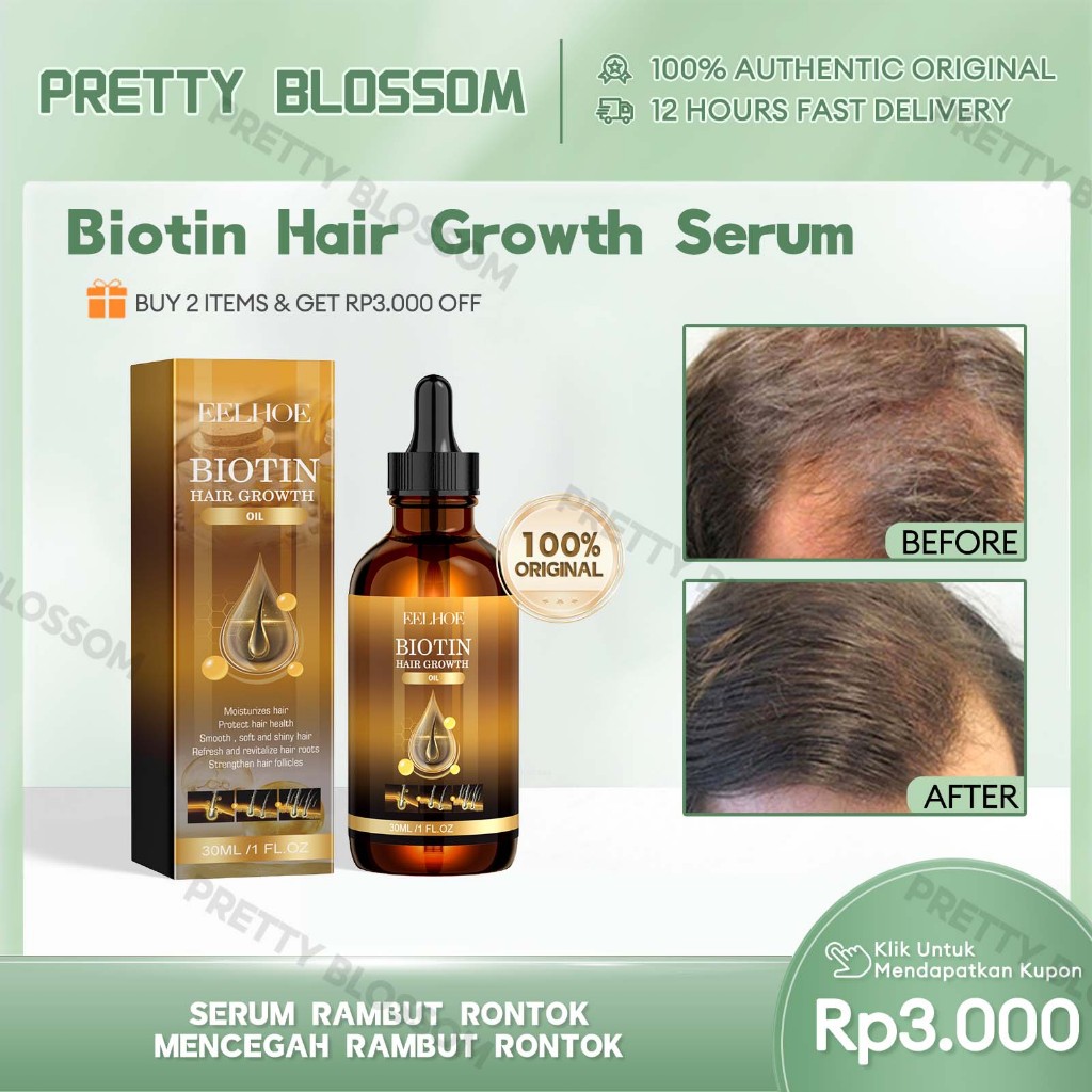 EELHOE Biotin Hair Growth Serum 30ml Serum Rambut Rontok Mencegah Rambut Rontok  Rambut Botak Paling