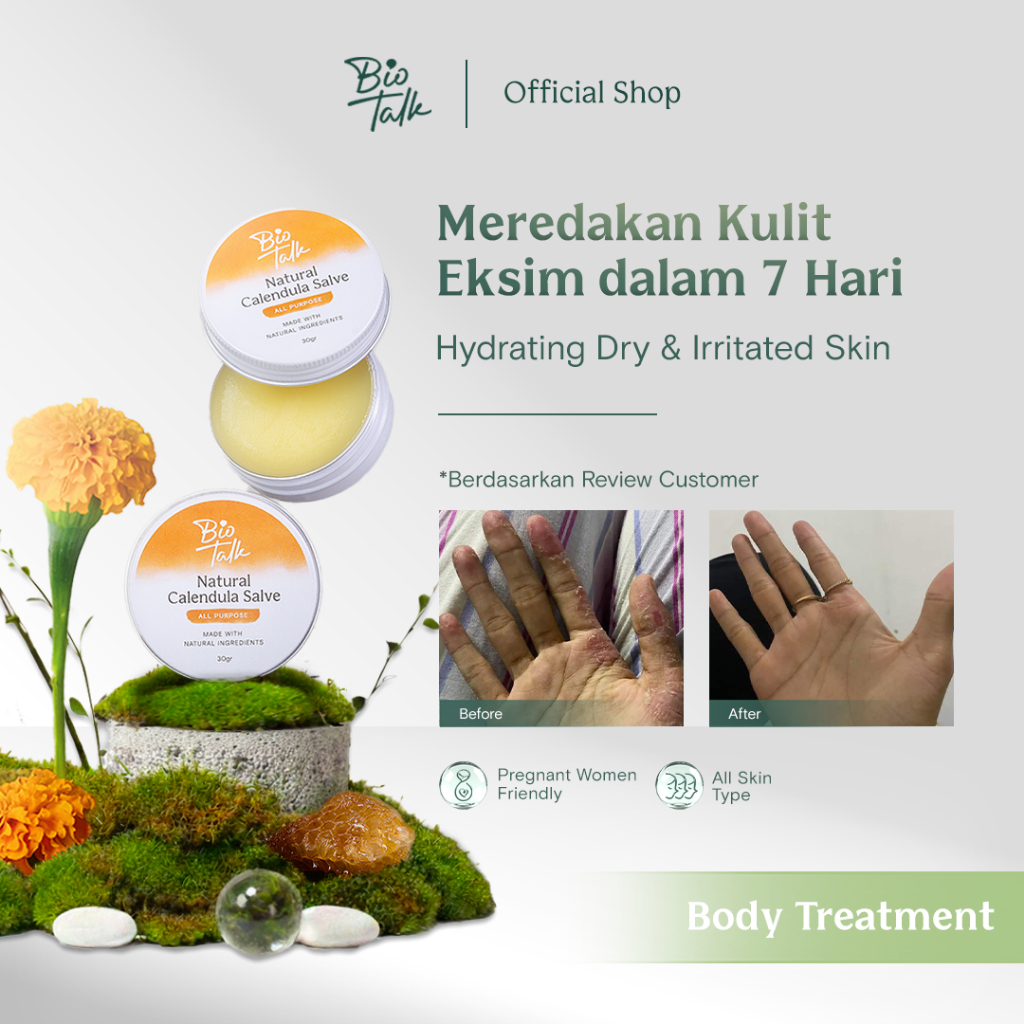 [FLASH SALE] Biotalk Natural Calendula Salve | No Steroid | Meredakan Kulit Eksim Psoriasis Sensitif
