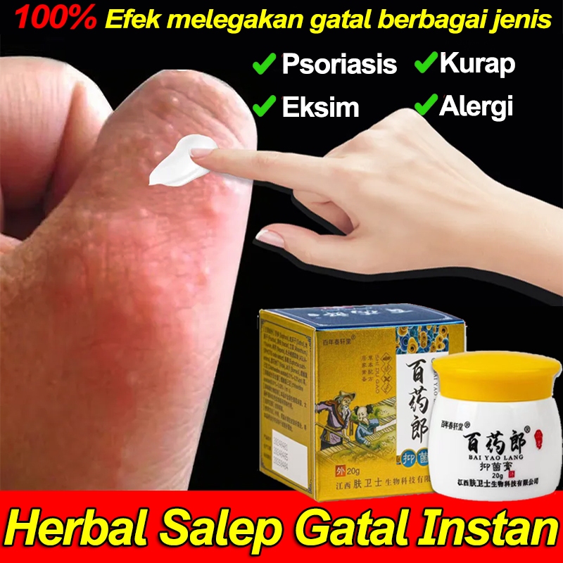Salep Eksim Kering dan Gatal Salep gatal China paling ampuh Salep gatal miss v Obat gatal selangkang