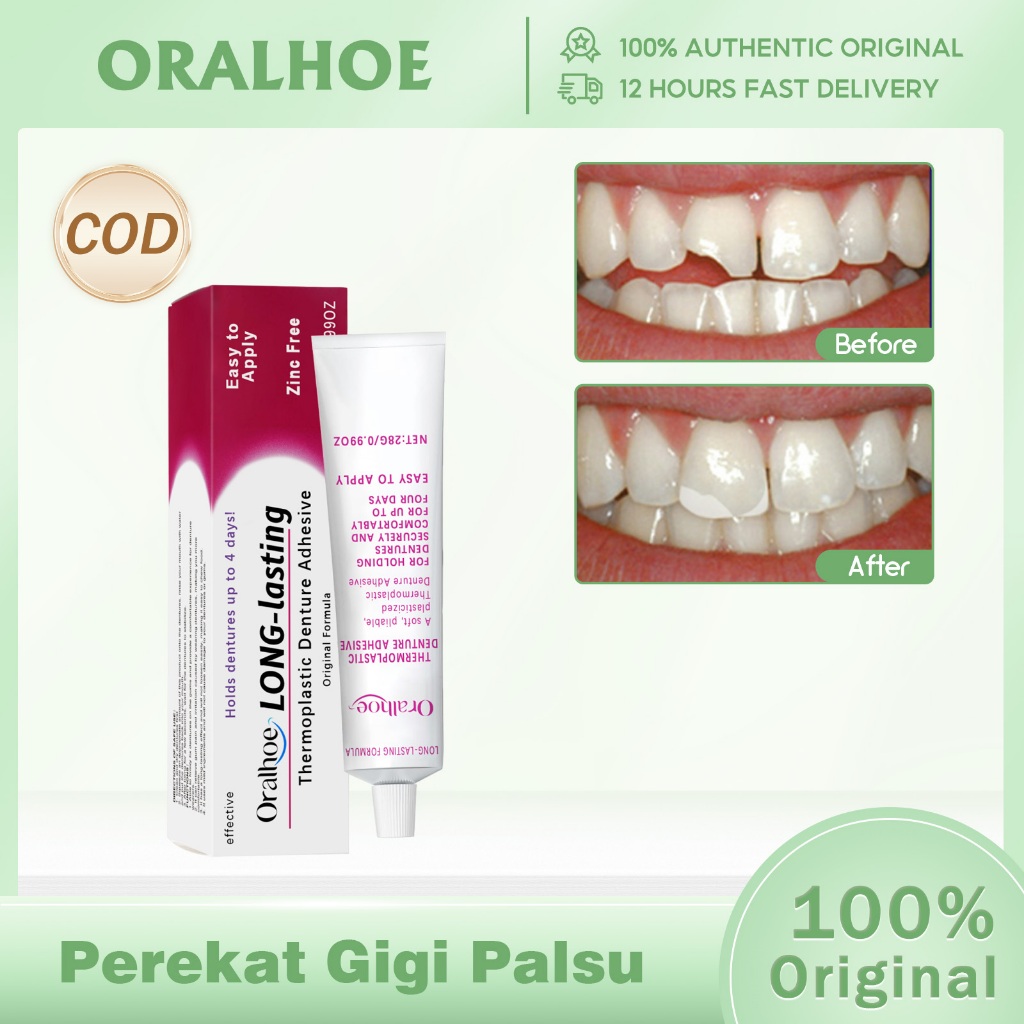 Oralhoe Perekat Gigi Palsu Thermoplastic Denture Adhesive 28g Gigi palsu perekat tetap Perekat Gigi 