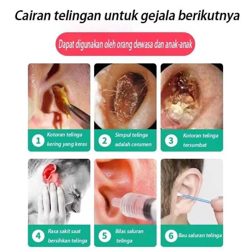 Obat Sakit Telinga,RACIKAN JEPANG Obat Telinga Air, Obat Tuli Tetap, Obat Sakit Telinga, Obat Teling