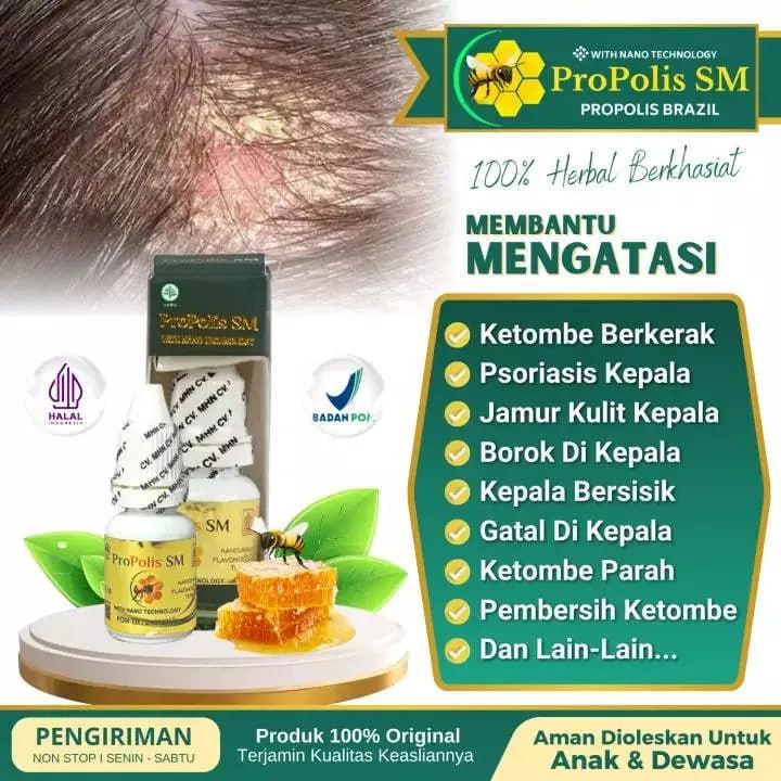 Propolis SM Original Atasi Ketombe dikepala, Ketombe berkerak, Ketombe Bau, Ketombe Parah