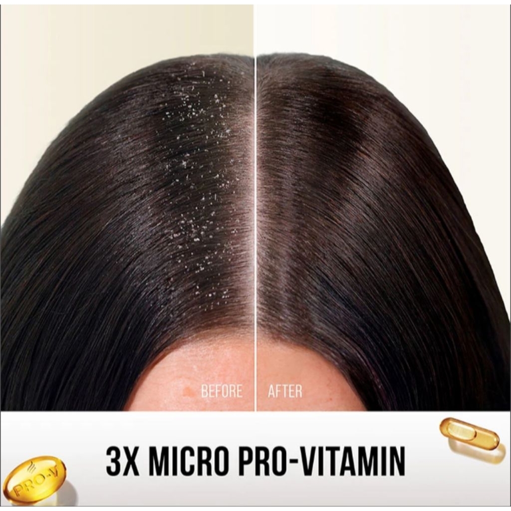 Pantene Sampo Anti Ketombe Botol 160 ml