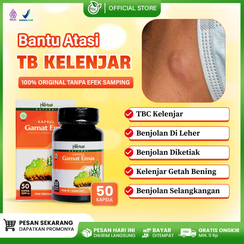 Obat Herbal TB Kelenjar, TB Kelenjar Getah Bening, Benjolan Di Leher Ketiak & Selangkangan Untuk Ana