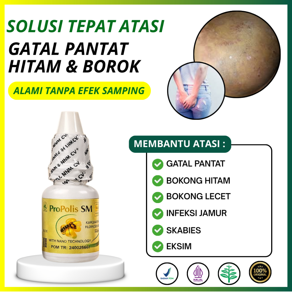 Obat Gatal Pantat Hitam Borok Bokong Lecet Infeksi Jamur Skabies & Eksim - Propolis SM Original BPOM
