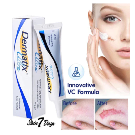 DERMATIX ULTRA CREAM MENGHILANGKAN BEKAS LUKA AMPUH