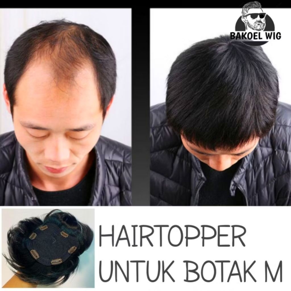 Wig Toupee Penutup Botak Pria Model 6 Hairclip Untuk Pria Botak Warna Hitam