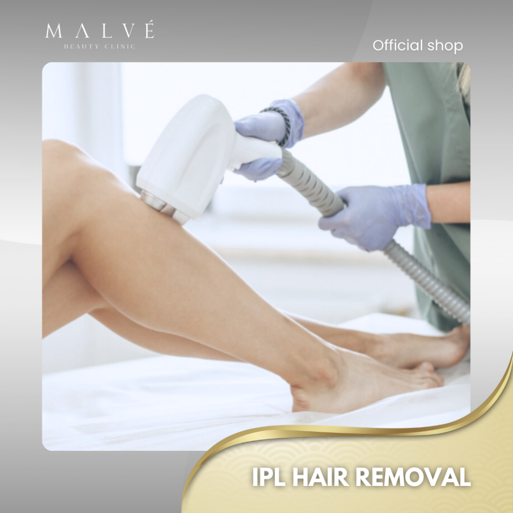 MALVE IPL Hair Removal