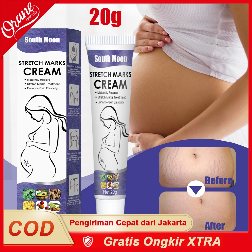 Oranebeauty 20g Krim Penghilang Stretch Mark / Krim Penghilang Stretch Mark Putih / Perawatan Tubuh 