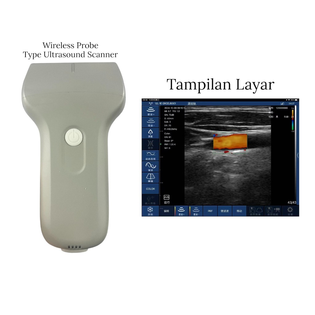 USG Portable Linear Wireless/USB - Wireless Probe Type Ultrasound Scanner - Alat Pemindai Ultrasonog