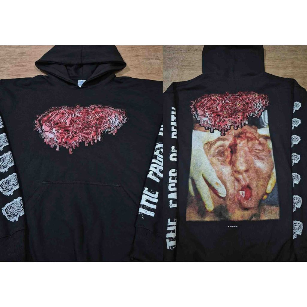 Original & Berlisensi Hoodie Fetal Deformity Goregrind