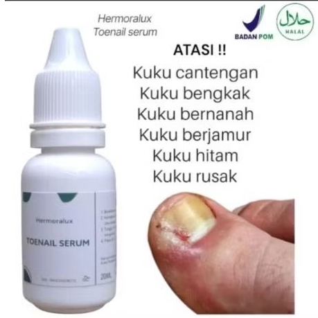 Obat Jamur kuku nyeri cantengan jamur