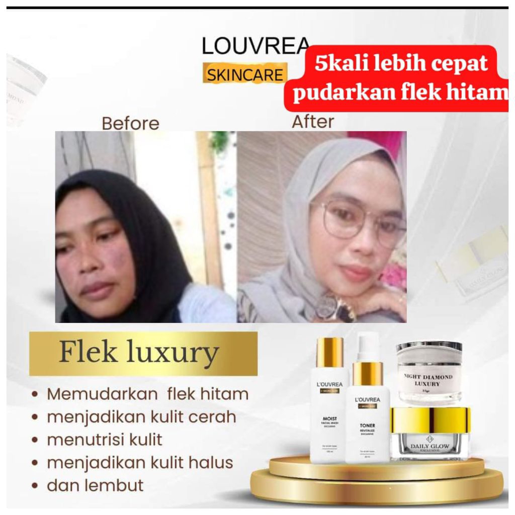 Paket flek luxury 1 Louvrea skincare