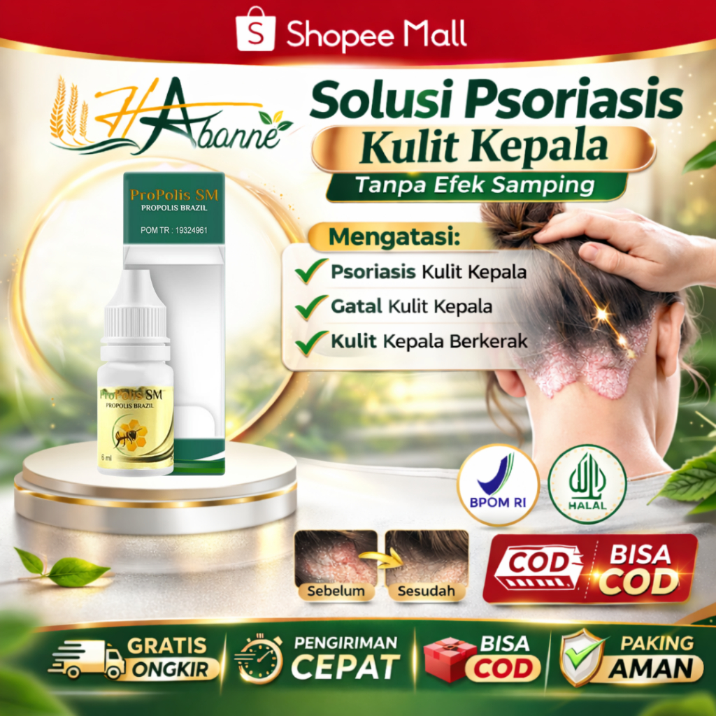 Obat Psoriasis Kulit Kepala Gatal Kulit Kepala Ketombe Berkerak Borok Di Kepala Tinea Capitis Propol