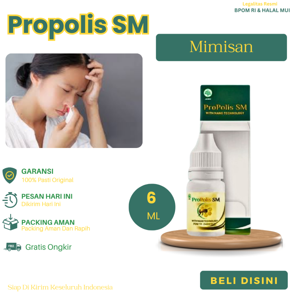 Obat Untuk Mimisan, Mimisan Menahun, Mimisan Berkepanjangan, Mimisan Disertai Sakit Kepala, Menghent
