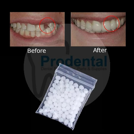 Temptooth / Gigi Palsu / Lem Gigi Padat / Gigi Veneer Buat Sendiri (150 butir)