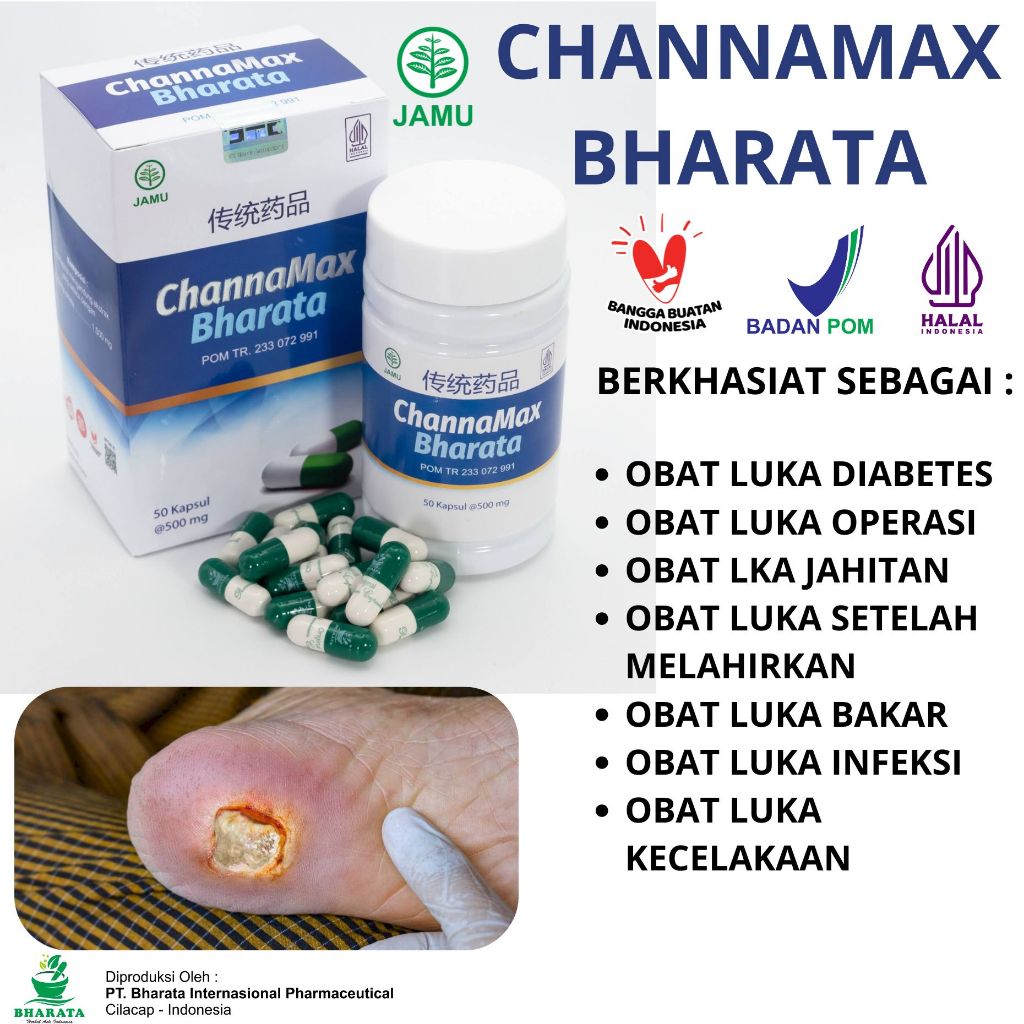 Obat luka diabetes ampuh CHANNAMAX BHARATA  luka bakar obat pasca caesar melahirkan luka bernanah