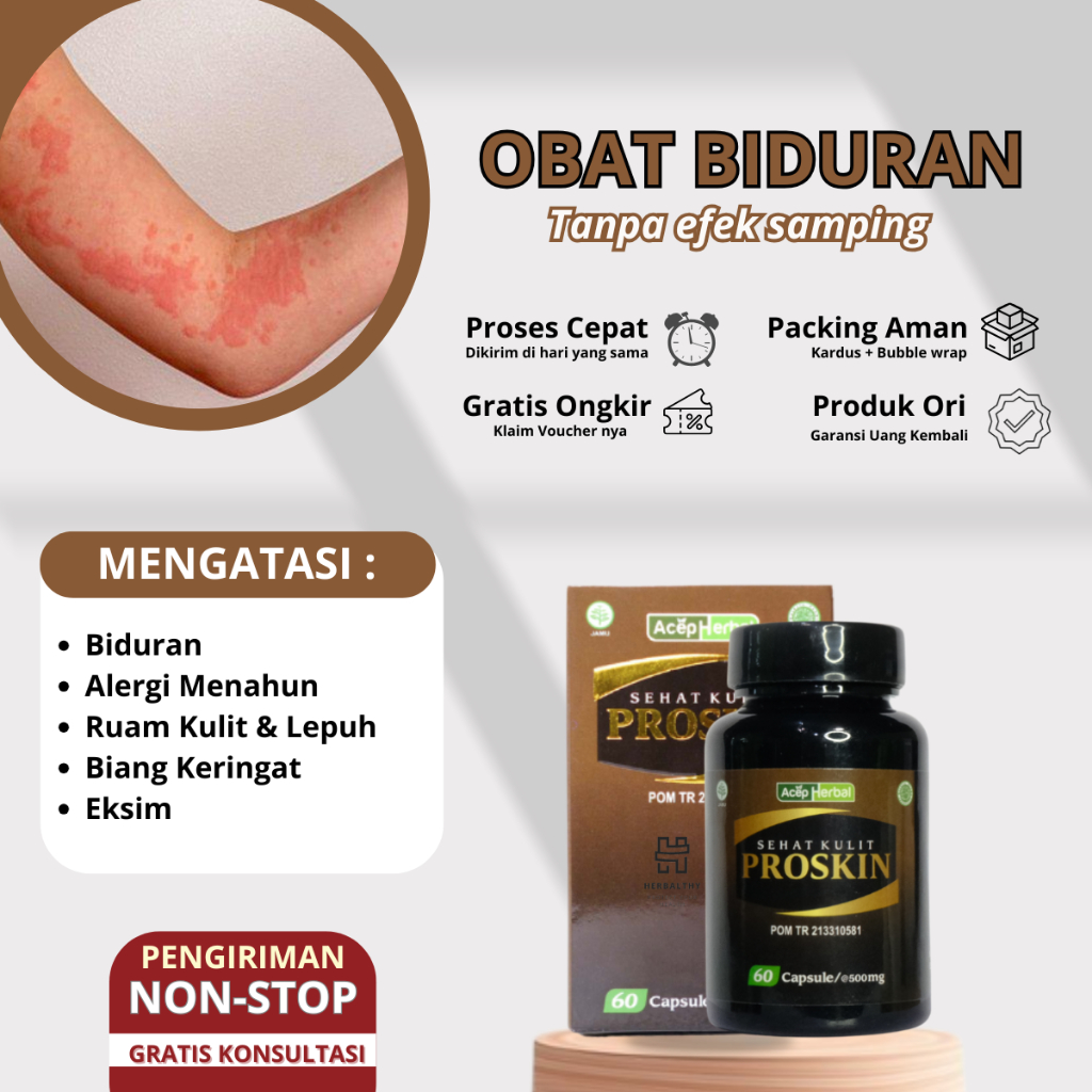 Obat Gatal Kulit Alergi Dingin Biduran Gatal Alergi Herbal Bentol Kulit, Biduran Kronis, Alergi Ding