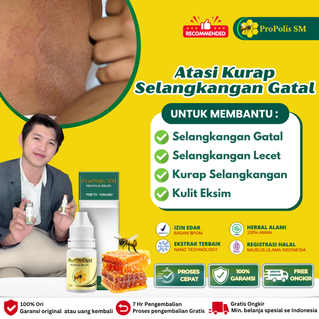 Obat Gatel2 Selangkangan, Kurap Selangkangan, Obat Oles Selangkangan Gatal Hitam Lecet, Gatal Selang