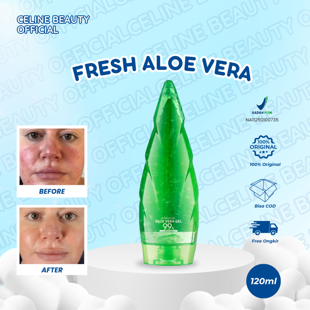 KORMESIC Fresh Aloe Vera 99% Soothing Gel
