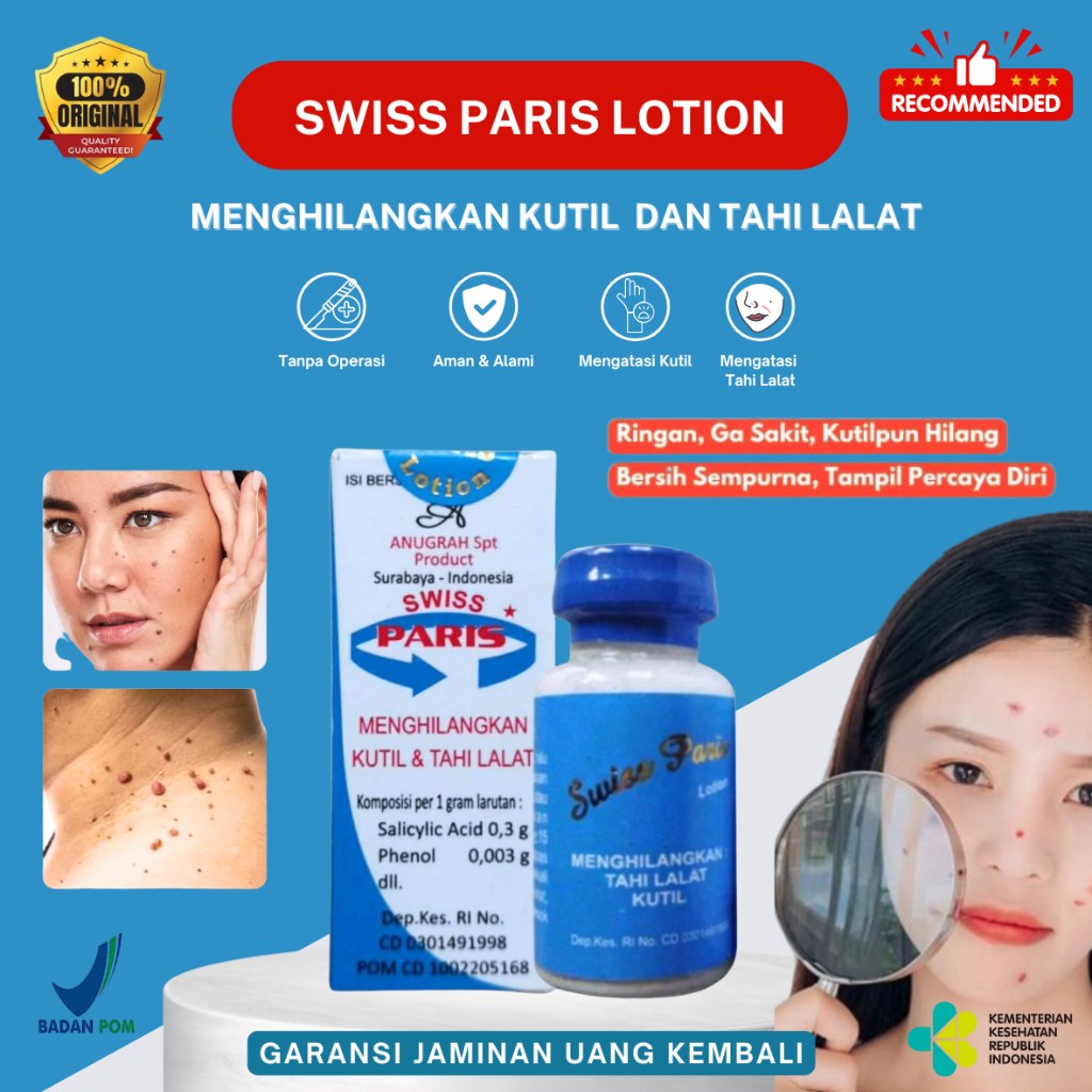 [ ORIGINAL ] Lotion Obat Penghilang Tahi Lalat Dan Kutil Di Wajah Swiss Paris Penghilang Tai Lalat K