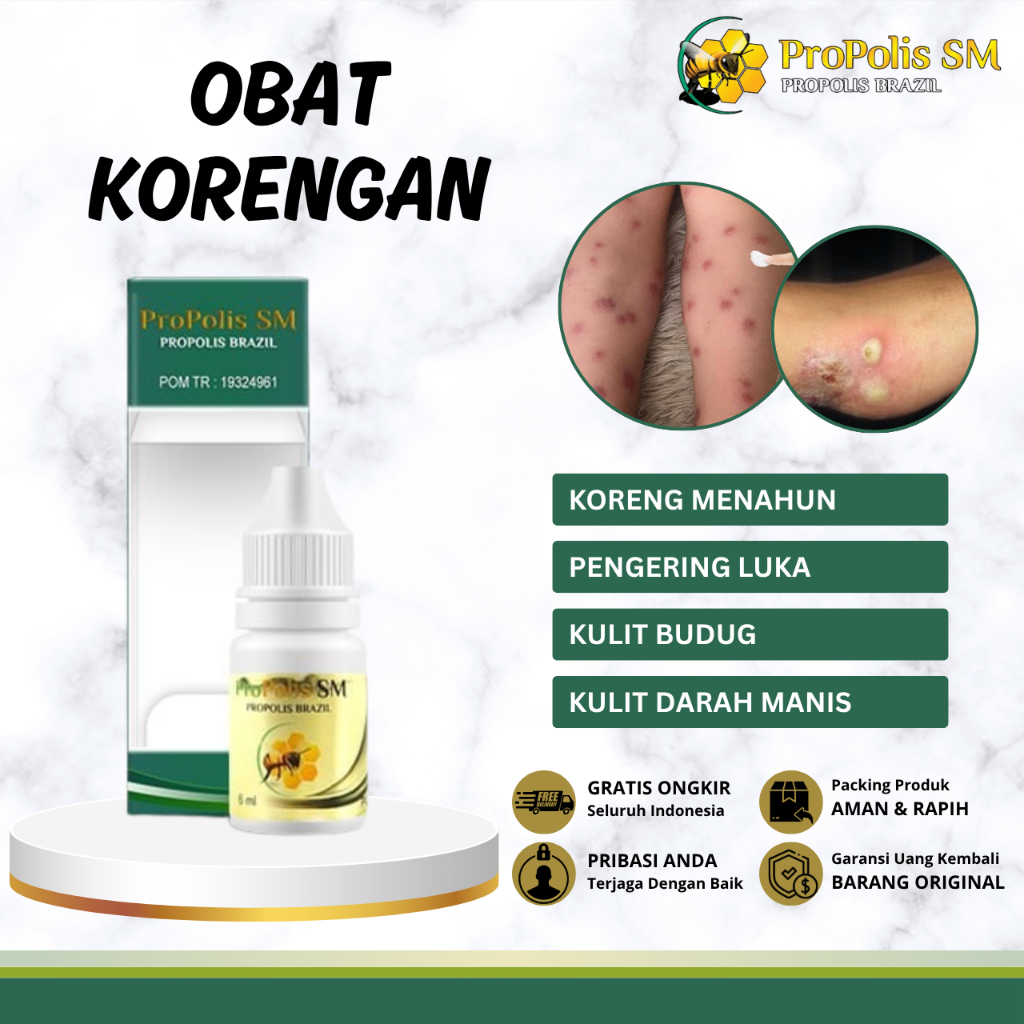 Obat Kulit Korengan, Obat Gatal Kulit Koreng, Obat Koreng Bernanah, Obat Kulit Borok, Obat Kulit Bud