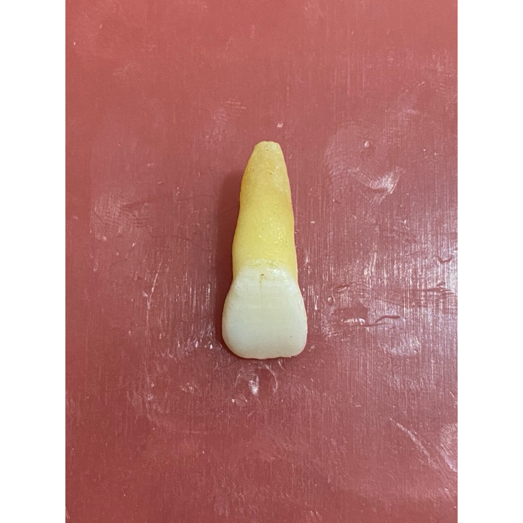 gigi insisivus rahang atas (gigi 11)