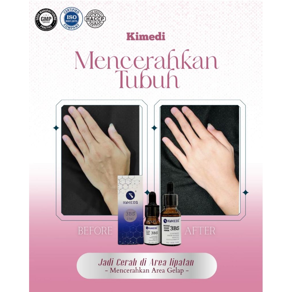 AFTER CARE KIMEDI PINKISH FOR  LIPS AND 3 BS BOOSTER BRIGHTENING KETIAK ARMPIT