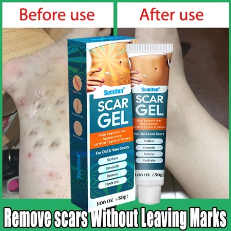 Penghilang Bekas Luka Scar Gel Penghilang Luka Koreng Bekas Gatal Gatal Penghilang Bekas Luka Hitam 