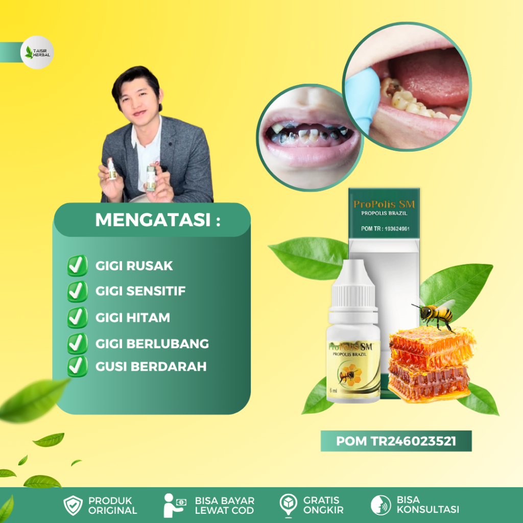 Obat Gigi Rusak Pada Anak - Obat Gigi Berlubang Hitam - Obat Gigi Keropos - Obat Tetes Sakit Gigi An