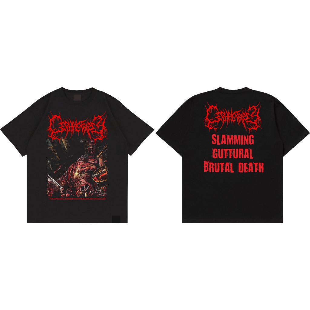 Musicislikemagic - T-shirt Band Cephalotripsy - Uterovaginal Insertion of Extirpated Anomalies